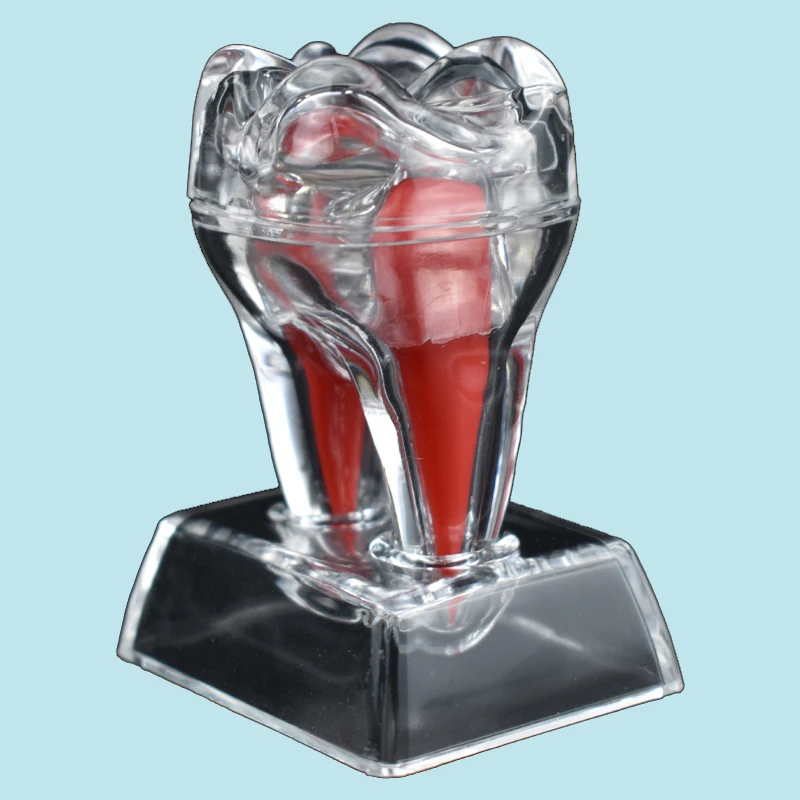 Прозрачная Стоматологическая Анатомическая модель Специалиста по разложению одного зуба, Обучающая Практическая модель